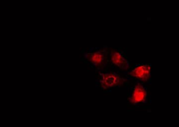 Polyclonal Rabbit anti-Human SMAD5 Antibody (IHC, IF, WB)