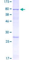 Human AMY1B Protein (Recombinant GST)