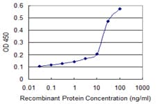 SRM / Spermidine Synthase Antibody (clone 2C1)