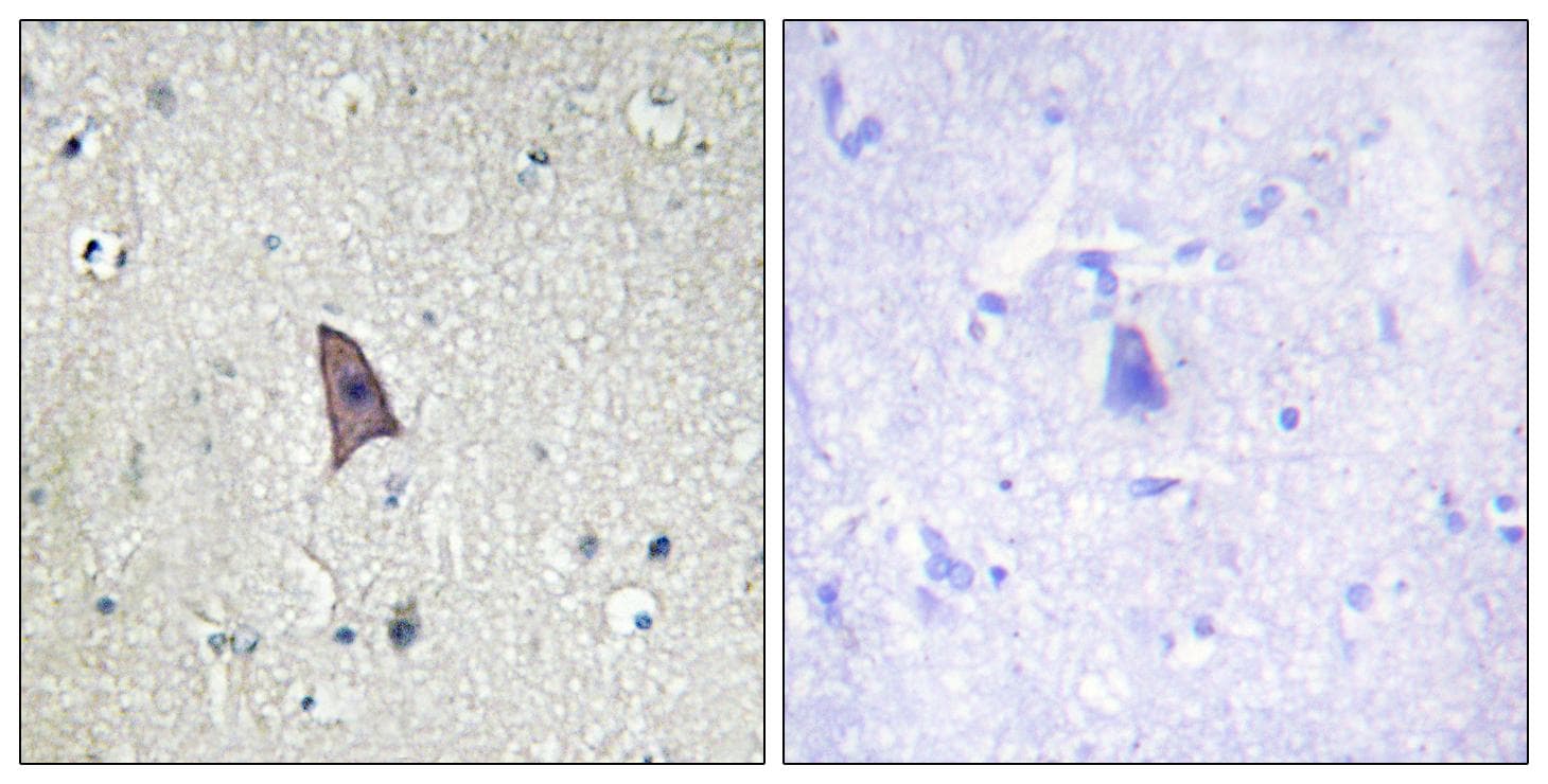 Polyclonal Rabbit anti-Human TEK / TIE2 Antibody (phospho-Tyr1102, IHC)