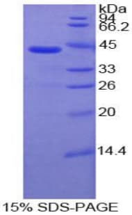 Human IL7R / CD127 Protein (Recombinant His-GST)