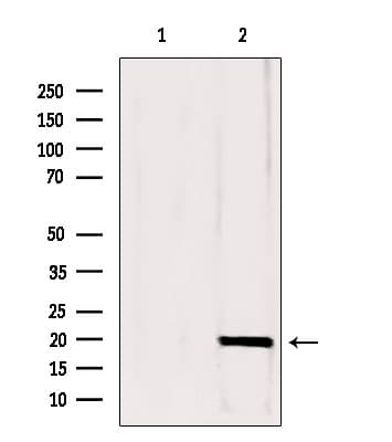 CPLX1 / Complexin 1 Antibody