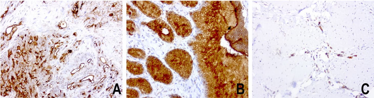EMA / MUC1 Antibody (clone UMAB57, Carrier-free)