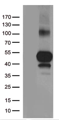 TNFRSF4 / CD134 / OX40 Antibody (clone OTI2B7)