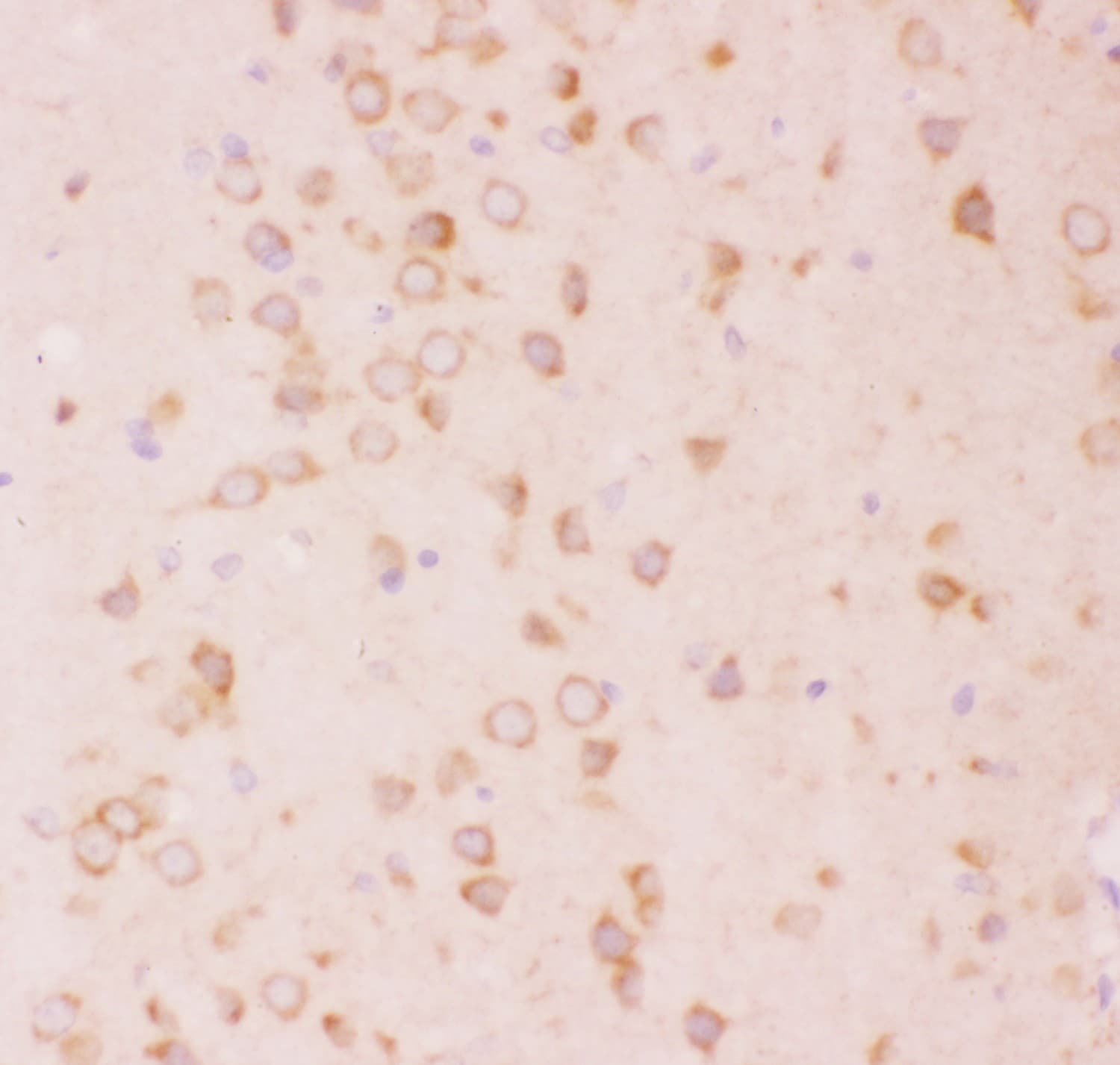 Tuberin / TSC2 Antibody (aa1611-1807)
