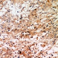 RPS6KA1 / RSK1 Antibody