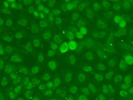 SSNA1 Antibody