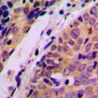 Polyclonal Rabbit anti-Human HARS Antibody (C-Terminus, IHC, IF, WB)