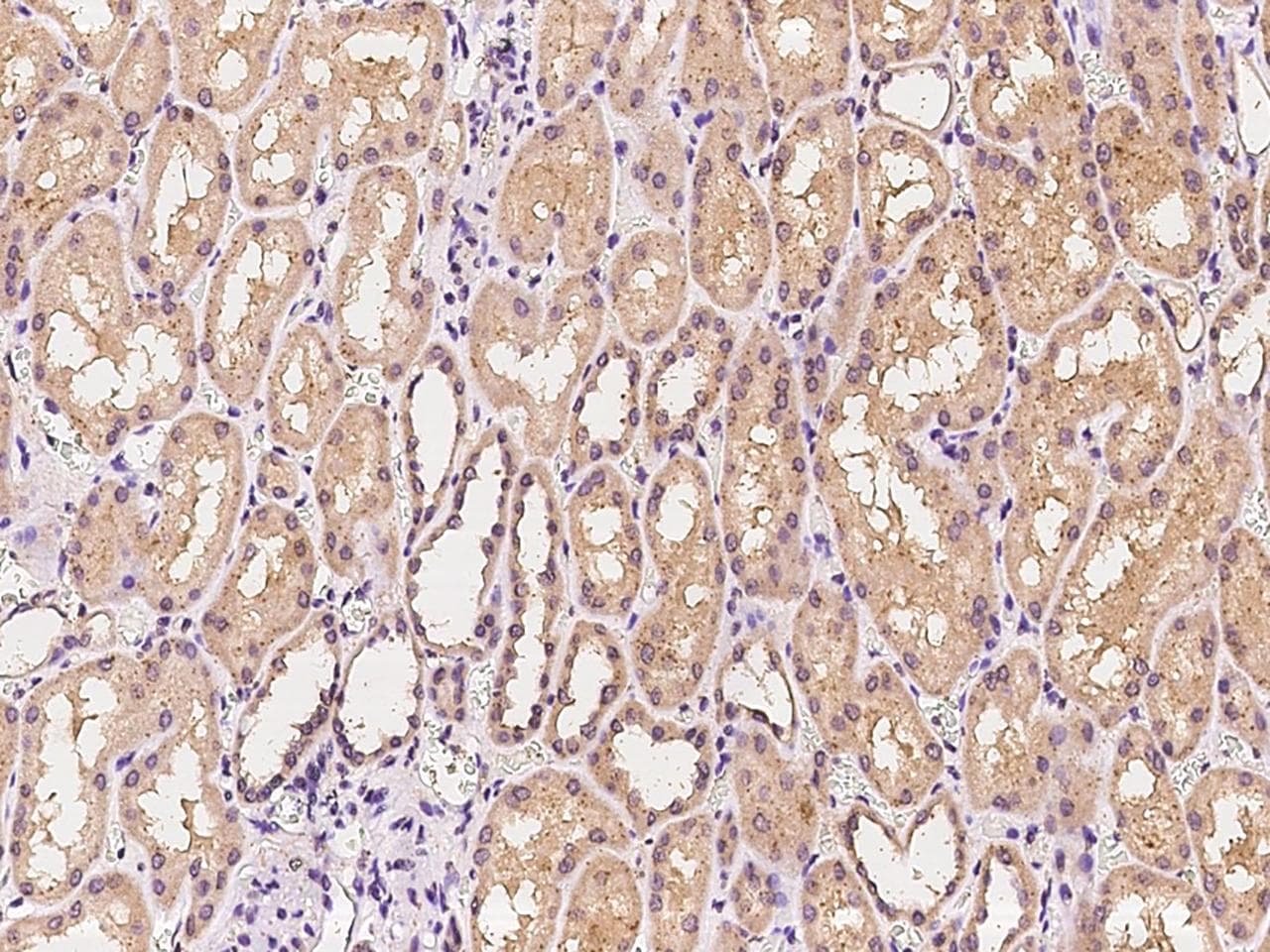 IDH3B Antibody