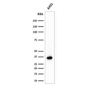NPM1 / NPM / Nucleophosmin Antibody (clone NPM1/1902)