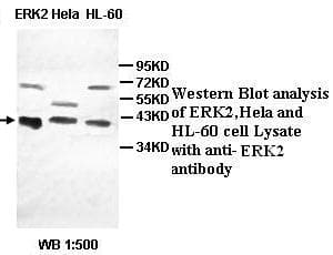 IHC-plus™ MAPK1 / ERK2 Antibody
