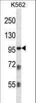 Polyclonal Rabbit anti-Human PKP2 / Plakophilin 2 Antibody (aa838-866, IHC, WB)