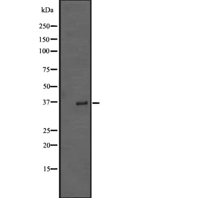 TRIB2 Antibody