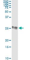 GSTP1 / GST Pi Antibody (clone 2G6-F6)