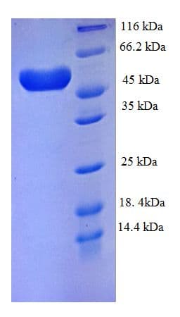 Human PLXNA4 / Plexin A4 Protein (Recombinant His)