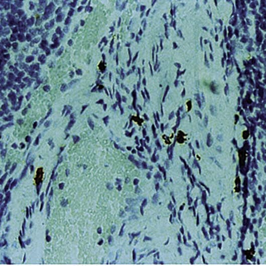 CMA1 / Mast Cell Chymase Antibody (clone CC1)
