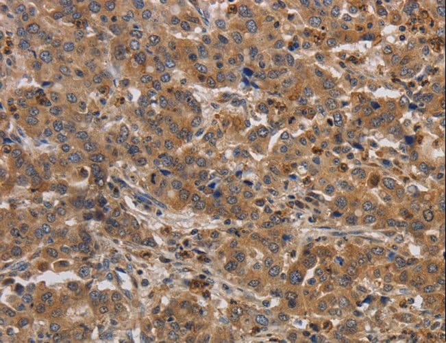 Polyclonal Rabbit anti-Human RAB22A / RAB22 Antibody (IHC, WB)
