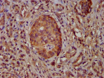 NEK5 Antibody