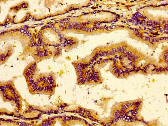 Polyclonal Rabbit anti-Human NTSR2 / NTR2 Antibody (IHC, WB)