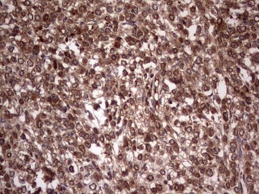 Monoclonal Mouse anti-Human BFSP2 Antibody (clone OTI4E7, aa184-415, IHC, WB)