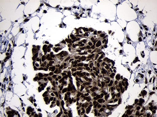 Monoclonal Mouse anti-Human HOXC4 Antibody (clone OTI1F6, IHC, WB)