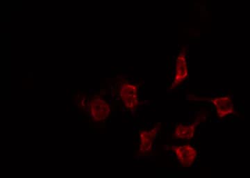 Polyclonal Rabbit anti-Human CCNF / Cyclin F Antibody (IHC, IF, WB)