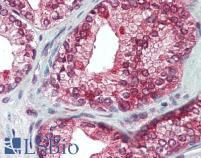 ADRA1A Antibody (3rd intracellular loop)