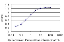 IHC-plus™ SPRR3 Antibody (clone 4A12)