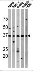 TP53 / p53 Antibody (phospho-Thr18)