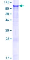 Human LRCH3 Protein (Recombinant GST)