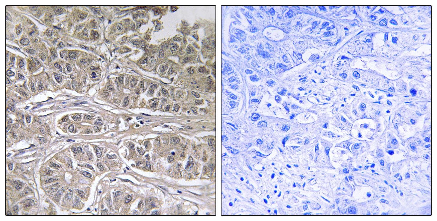 Polyclonal Rabbit anti-Human SLC25A21 / ODC1 Antibody (IHC, WB)