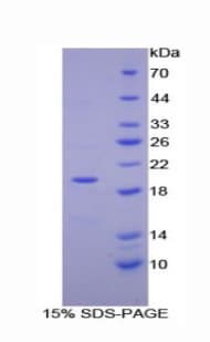 Human ENPP1 Protein (Recombinant His)