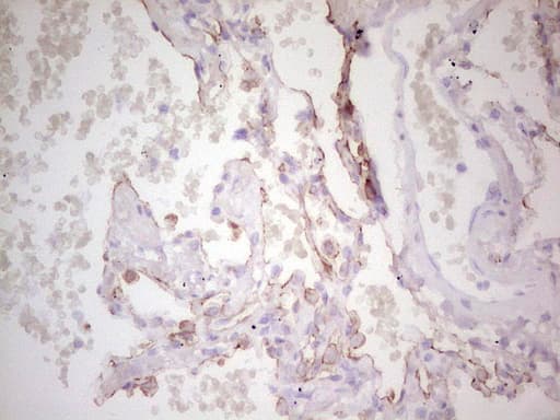 ABCB1 / MDR1 / P Glycoprotein Antibody (aa995-1280, clone OTI1A7)