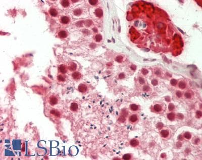 IHC-plus™ DICER1 / Dicer Antibody (aa600-650)