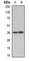 Polyclonal Rabbit anti-Human TEL-2 / ETV7 Antibody (WB)