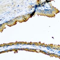 MTERF3 / MTERFD1 Antibody