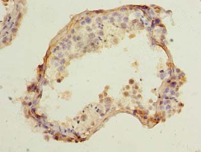 CCDC42 Antibody (Coiled-coil domain)