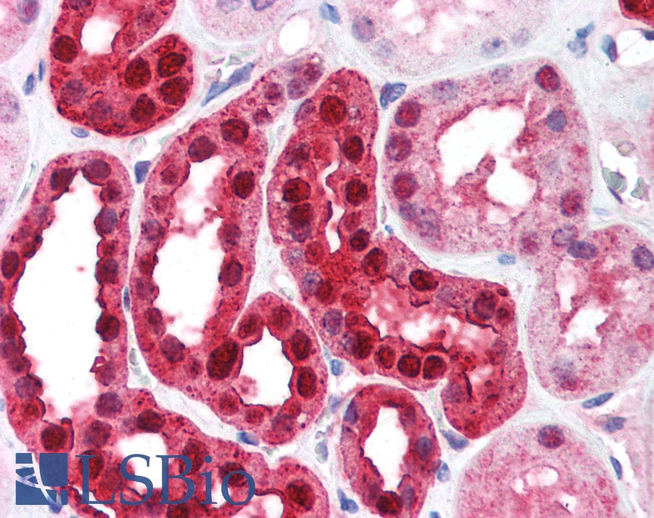 IHC-plus™ Polyclonal Rabbit anti-Human CA2 / Carbonic Anhydrase II Antibody (IHC, WB)