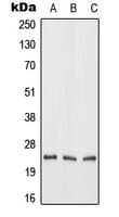 FGF19 Antibody (Internal)