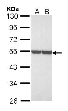 PathPlus™ Polyclonal Rabbit anti-Human ENO1 / Alpha Enolase Antibody (aa199-434, IHC, WB)