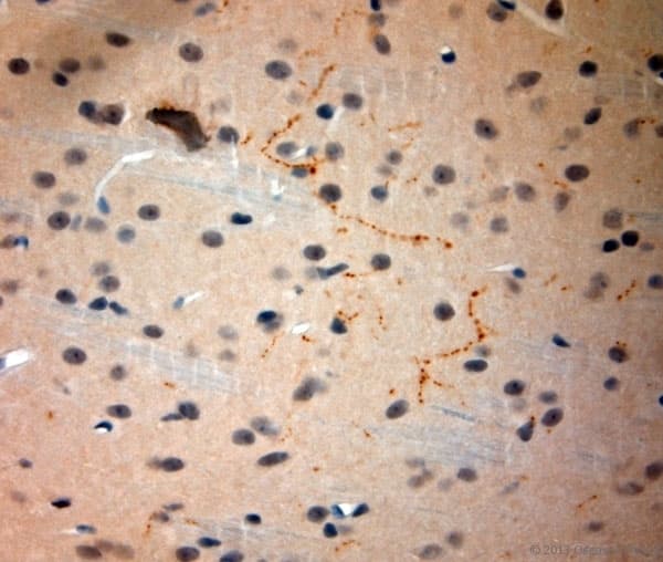 Polyclonal Rabbit anti-Rat SYNPO / Synaptopodin Antibody (aa890-930, IHC)