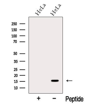 MMS2 / UBE2V2 Antibody