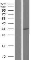 Human NR1I3 / CAR Protein (Over-Expression Lysate Myc-DDK (Flag))