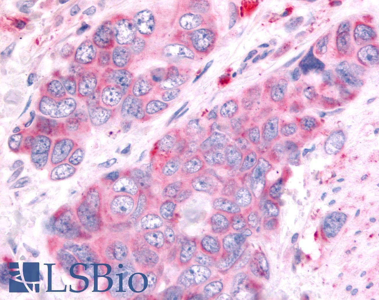 PathPlus™ Polyclonal Rabbit anti-Human OR6K3 Antibody (C-Terminus, IHC)