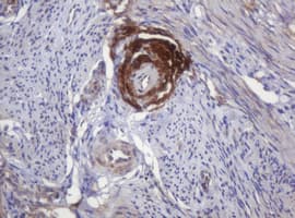 PARVB Antibody (clone OTI2H1)