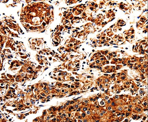 APLP1 / APLP-1 Antibody