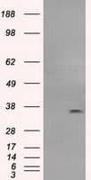 CD32A Antibody (clone OTI20D1)