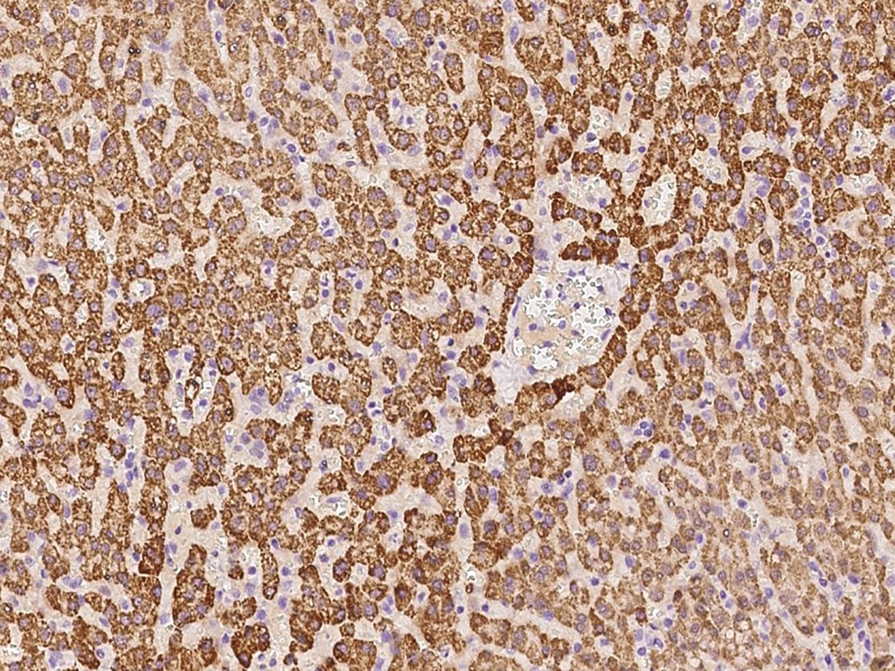 ACSS3 Antibody