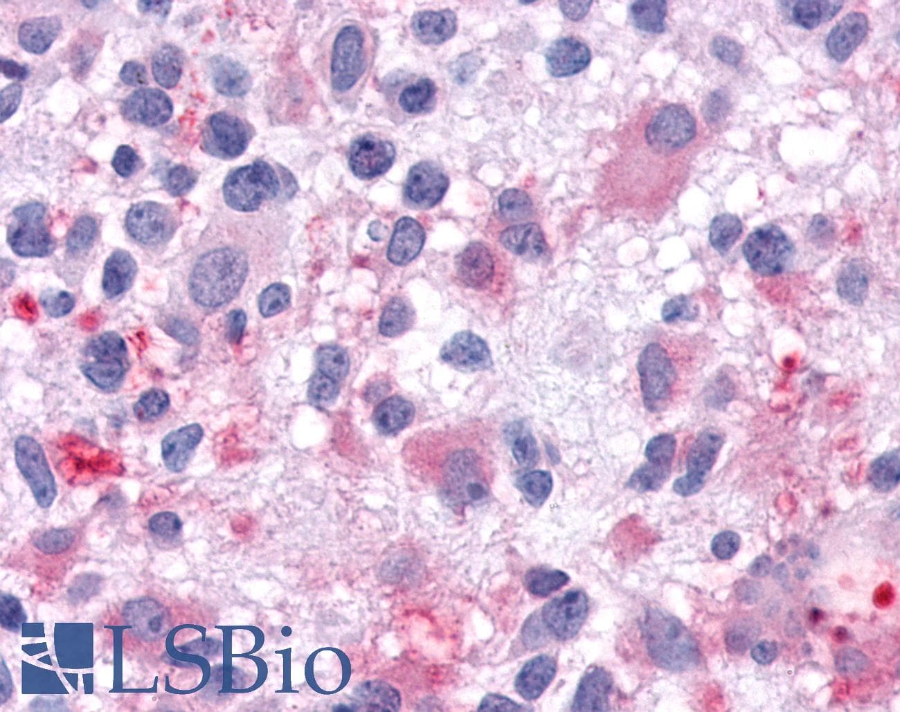 PathPlus™ GALR1 / Galanin Receptor 1 Antibody (N-Terminus)