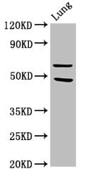 Polyclonal Rabbit anti-Human PAK4 Antibody (IHC)